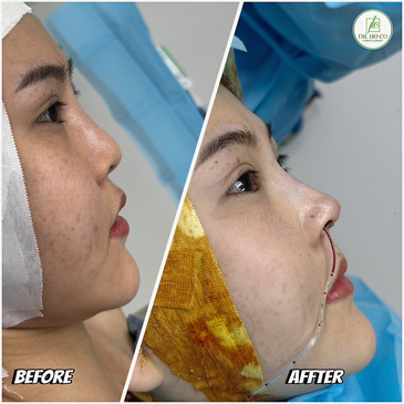 Slider image (6) Dr. Ho Co - Aesthetics and Plastic Surgery in Vietnam
